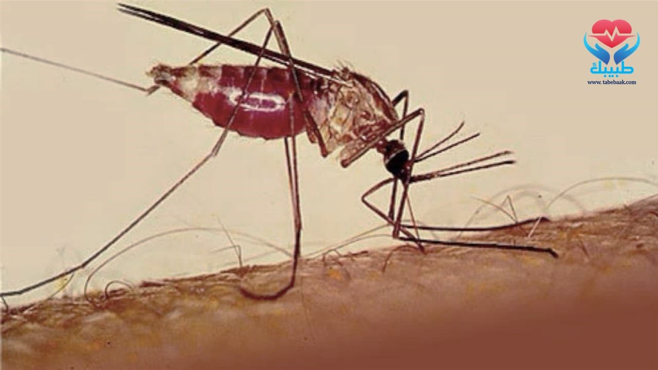 مرض الملاريا والأعراض المصاحبة والعلاج